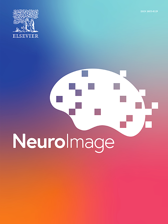 신경영상 저널_NeuroImage. 사진=한국외대 제공